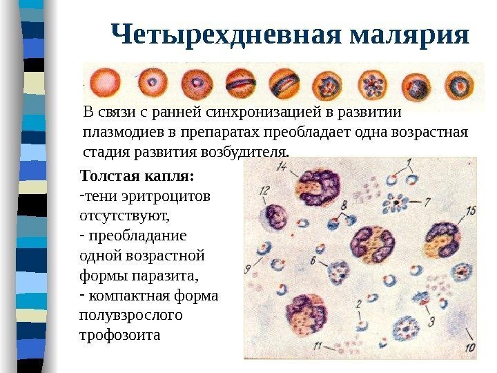Четырехдневная малярия Толстая капля: - тени эритроцитов отсутствуют, -  преобладание одной возрастной формы
